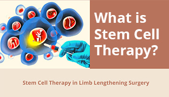 What is Stem Cell Therapy?